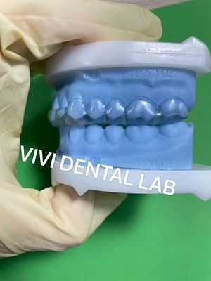 Stabiele Michigan Splint Tandspalk met perfecte pasvorm en professionele kwaliteit