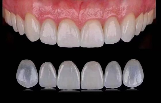 Translucent Emax laminaatfoelie / porseleinen tandheelkundige foelie ISO goedgekeurd