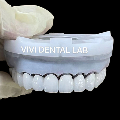 Superwitte circonia tandheelkundige lab kronen 3D PRO PFZ Noritake porselein