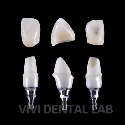 Tandheelkundig implantaat Tibase Zirconia Abutment Titanium nauwkeurigheid Op maat