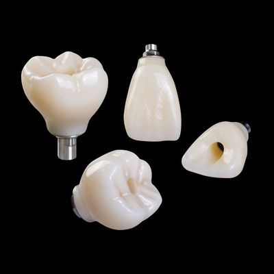 Professionele Zirconia tandheelkundige implantaten Kroon Titanium CAD CAM