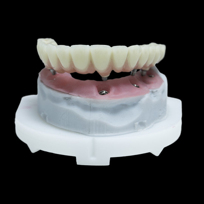 Alle op 4 PFM tandheelkundige implantaten kroon Titanium Zirconia Alle op 6 herstelwerkzaamheden