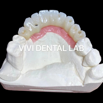 PMMA Precision Full Zirconia Bridge over Multi Unit Abutments