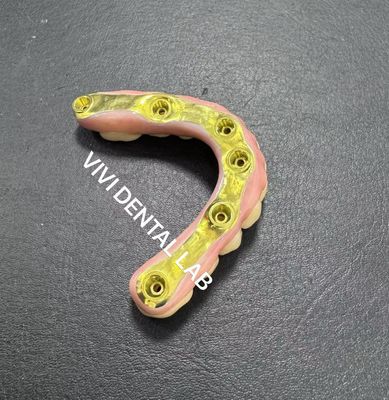 Volledige Zirconia brug met titanium staaf ondersteuning China tandheelkundige laboratorium