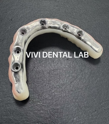 CHINA VIVI DENTAI LABORATORY certificaten