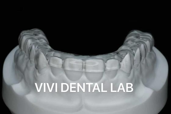 Hoogwaardige occlusal splinter van het beste materiaal door China tandheelkundige laboratorium