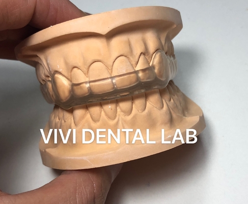 Nacht tandheelkundige mondbeschermer Occlusal Splint Ekodent Good Fit Hoog esthetiek