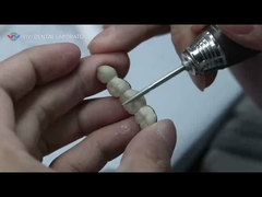 Metalen Keramische brug