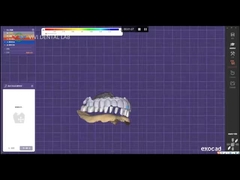 Digitale tandheelkunde