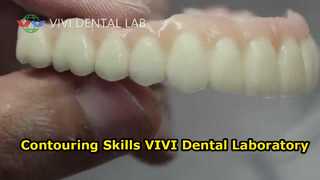 Vormcontourvaardigheden VIVI Dental Laboratory China