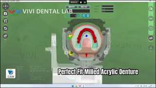 Gefreesd acryl kunstgebit Superior Fit Digital
