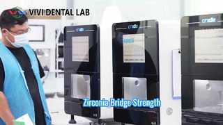 Zirkoniabrug Sterk esthetisch VIVI Dental Lab